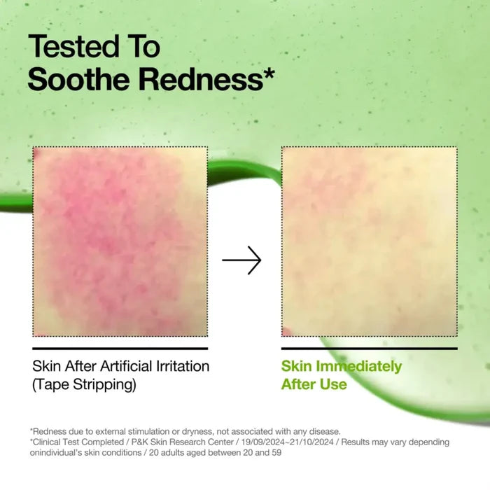 Azelaic Acid 10 Hyaluron Redness Soothing Serum 30ml - and Ampoule Anua Face Serums