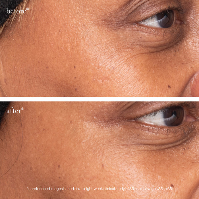 Goop-3X Retinol Eye Lift Serum-Skincare-3xretinoleyeliftserum_imgCarousel_beforeandafter-The Detox Market |