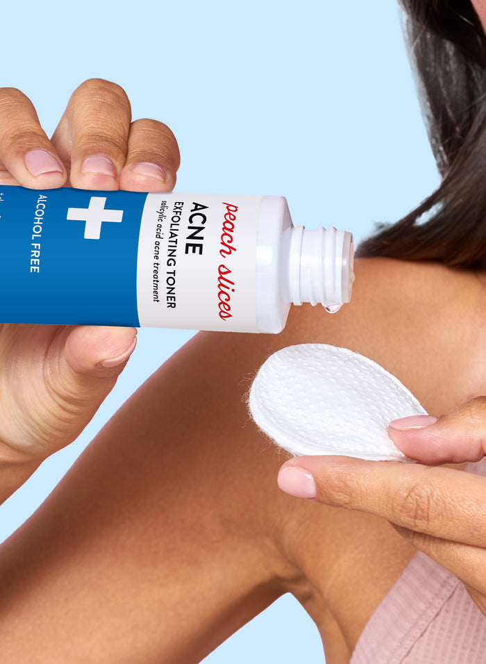 Acne Exfoliating Toner