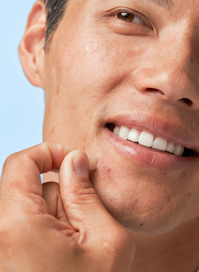 Acne Spot Treatment Trio