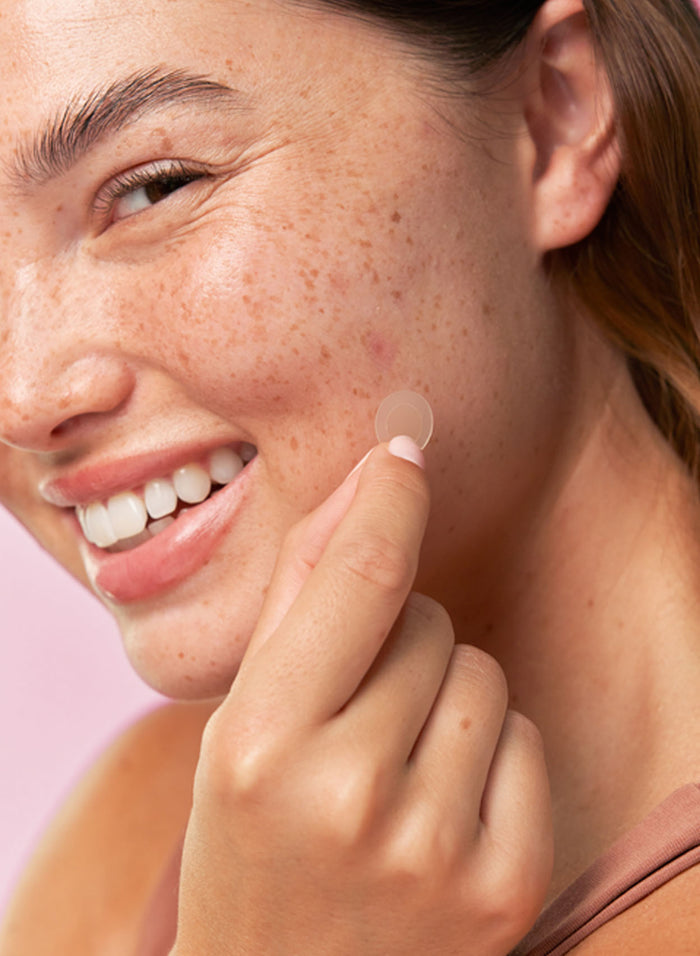 Acne Spot Treatment Trio