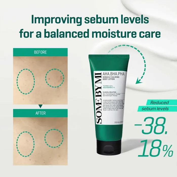 AHA BHA PHA Miracle Calming Body Lotion - Care SomeByMi Lotions & Moisturizers