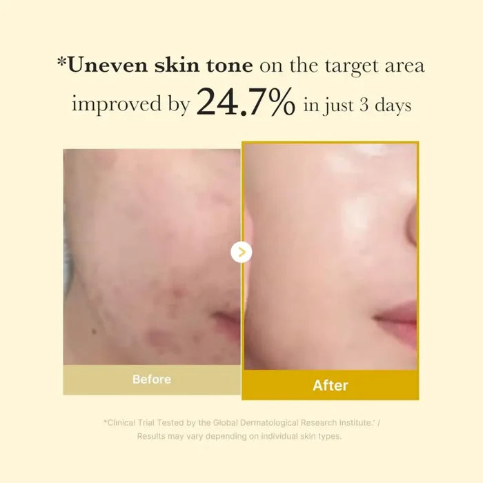 Kojic Acid Turmeric Overnight Wrapping Mask 75ml - Medicube Skin Care Masks & Peels