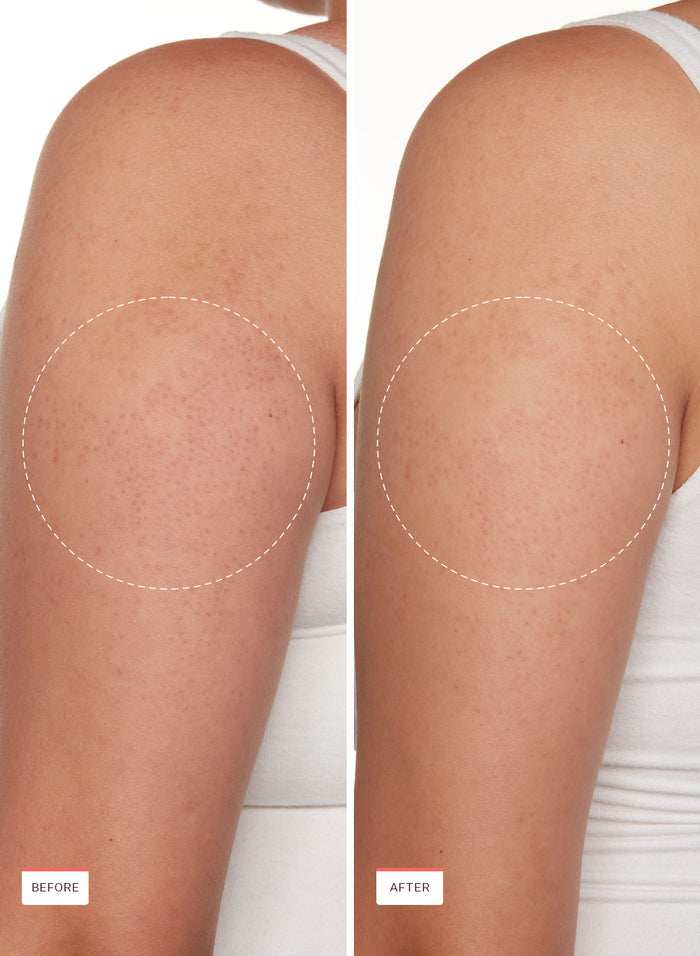 KP Bump Boss Smoothing Body Lotion