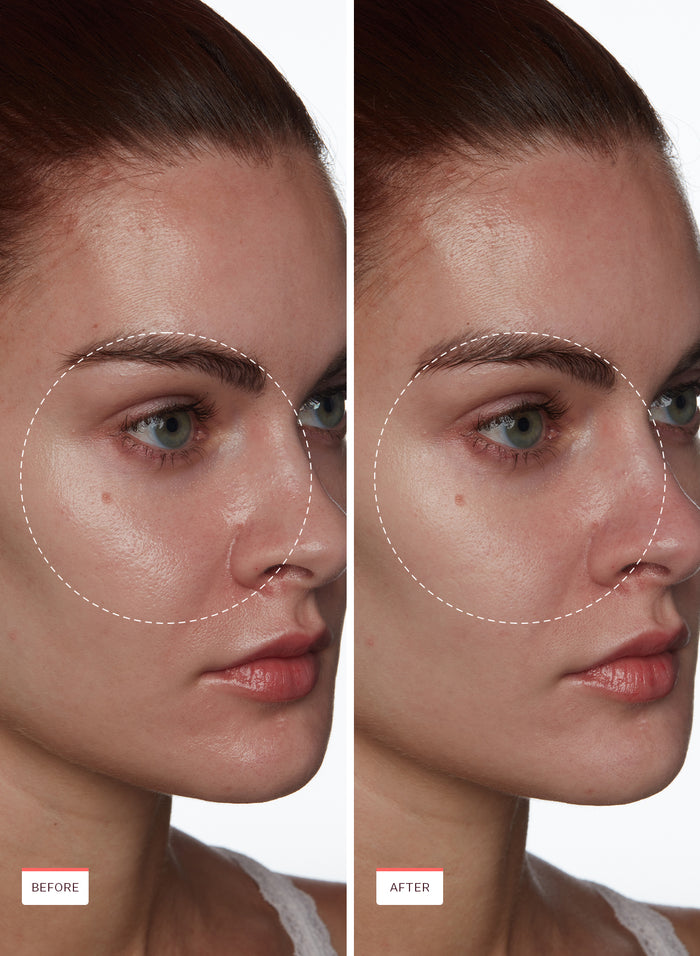 Oil Control Balancing Cleanser