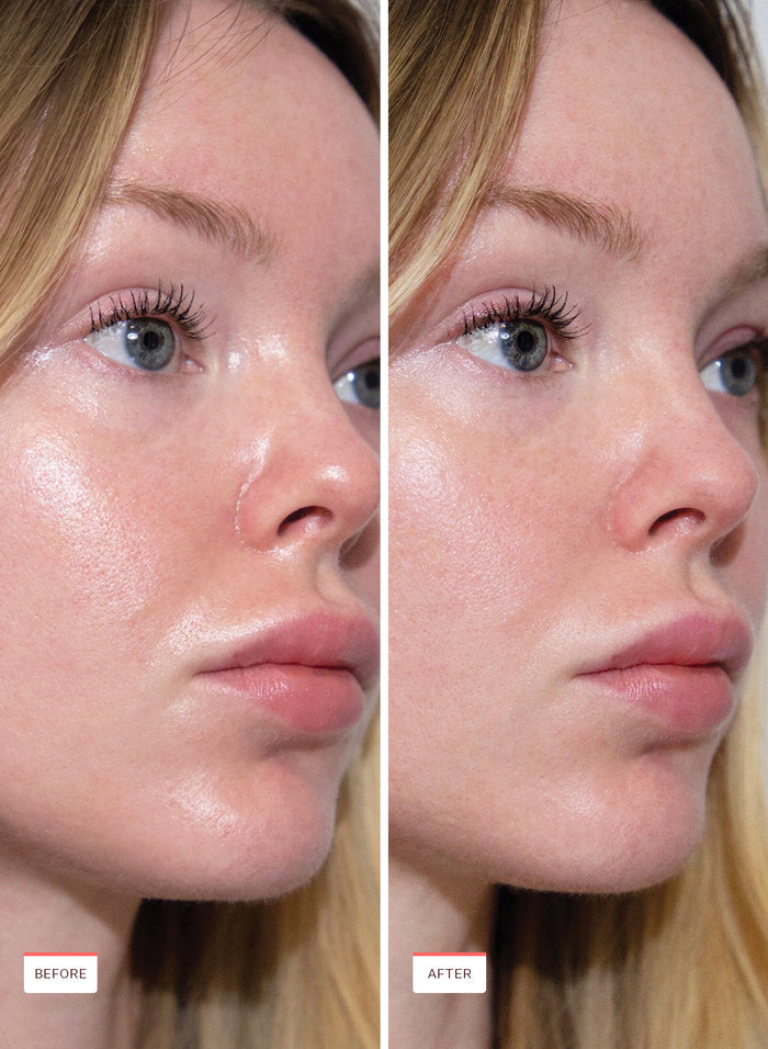 Oil Control Pore Serum