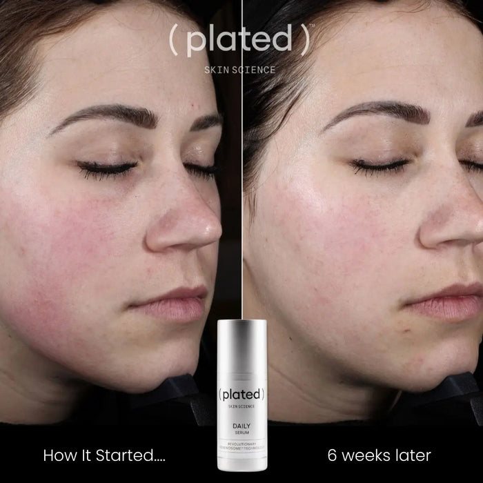 (plated) Daily Serum ( plated )™ Skin Science