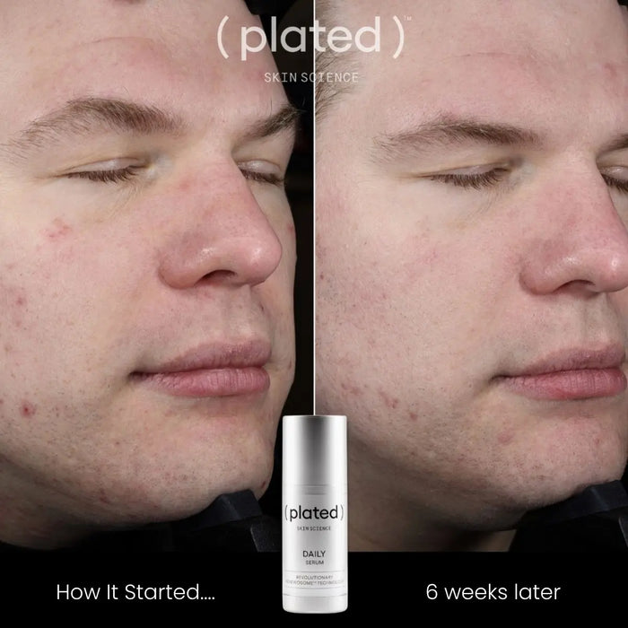 (plated) Daily Serum ( plated )™ Skin Science