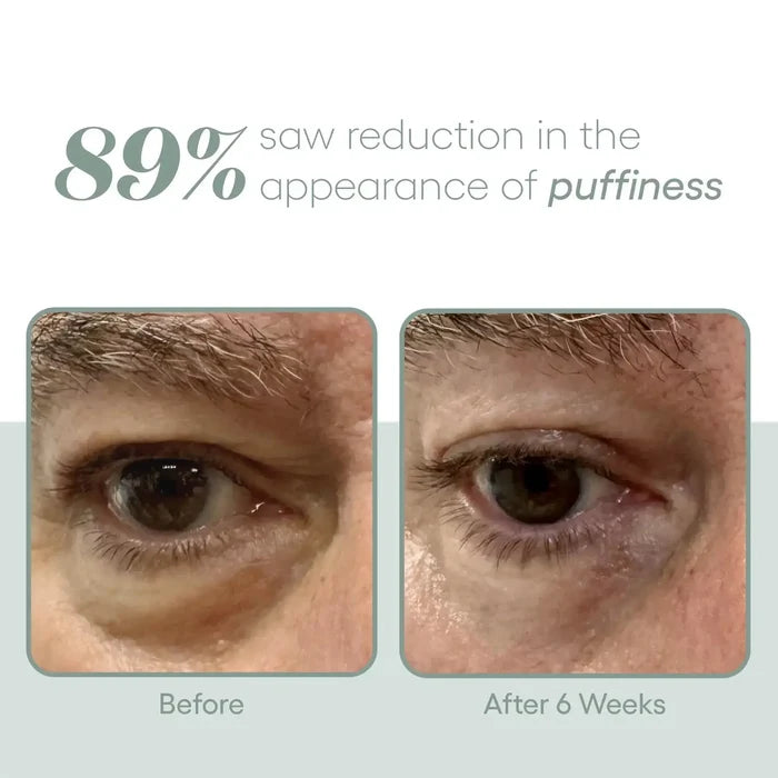 (plated) Eye Serum ( plated )™ Skin Science