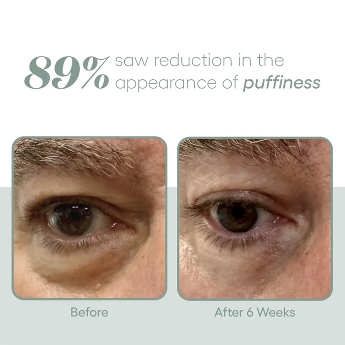 Plated Eye Serum