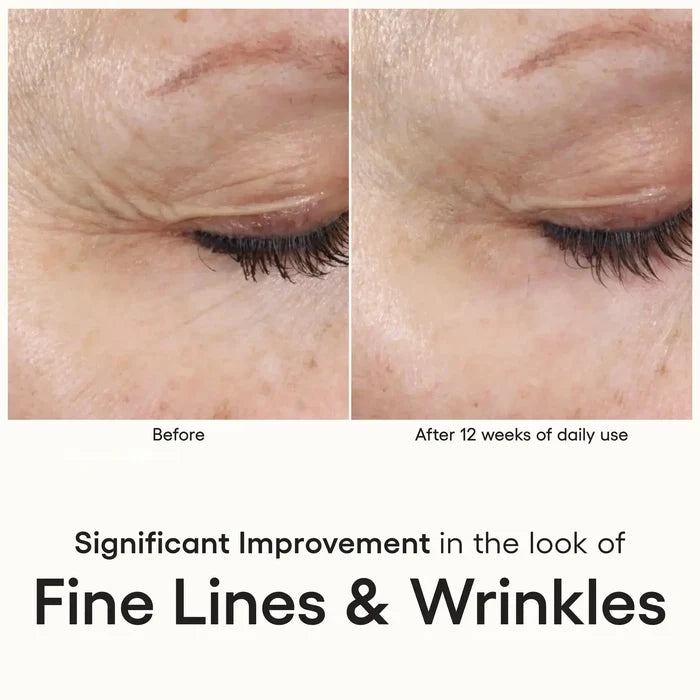 (plated) Intense ( plated )™ Skin Science