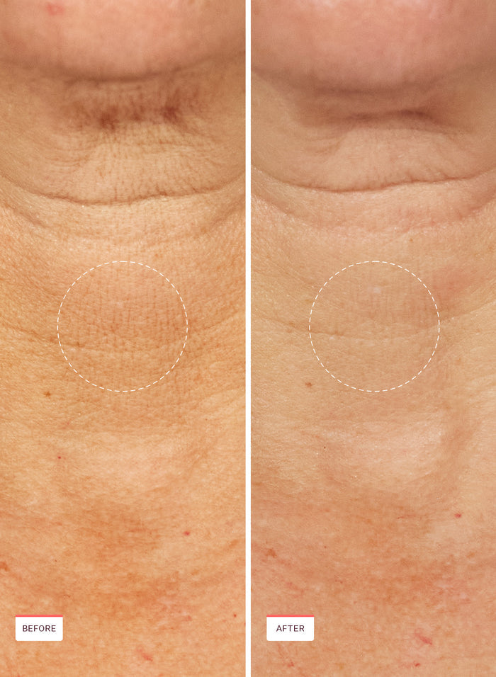 Power Cocktail Lactic Acid Repair Serum