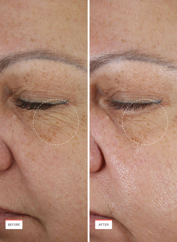 Retinal For All Renewing Serum