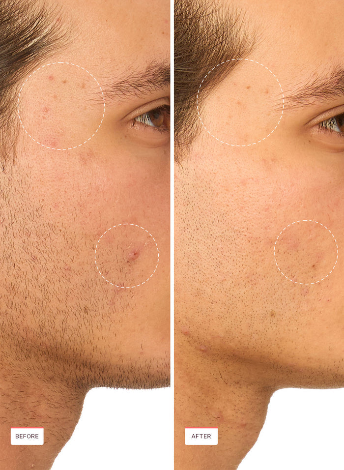 Snail Rescue Blemish Busting Toner