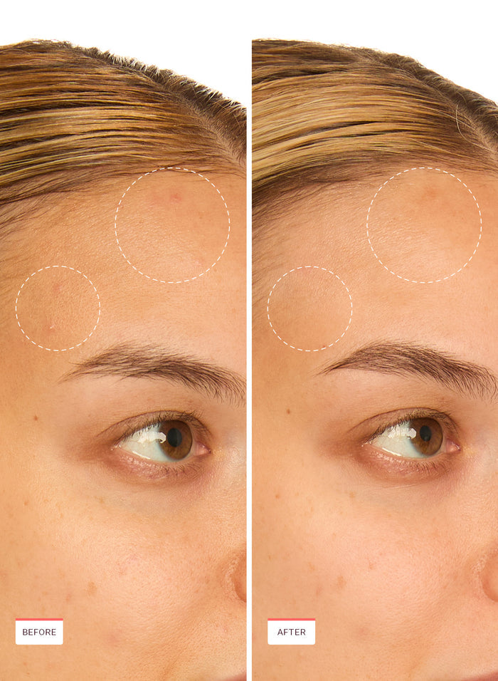Snail Rescue Intensive Serum