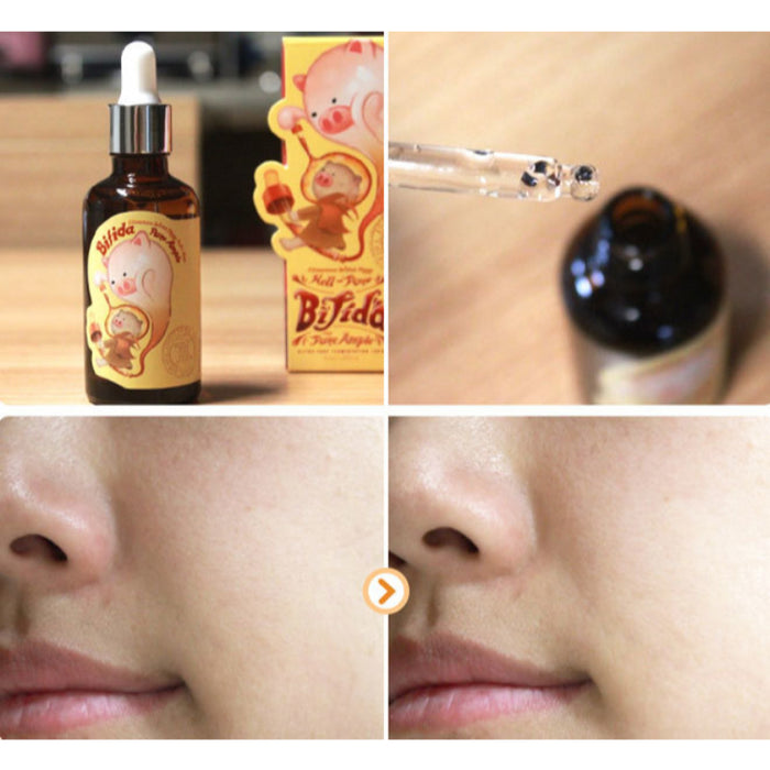 Elizavecca Witch Piggy Hell-Pore Bifida Pure Ample - Korean-Skincare